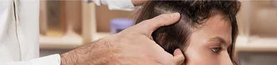A close-up of a person's head, focusing on their scalp and hair, with a hand gently touching the hairline. The person's profile is visible, showcasing their features and hairstyle.