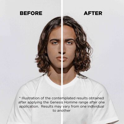 Reduces Hair-Fall In 6 Weeks