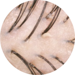 image of scalp under white LED light
