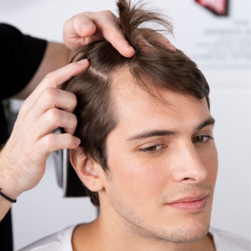 A man showing signs of hair loss having his scalp inspected 
