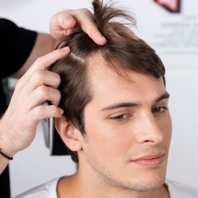 A man showing signs of hair loss having his scalp inspected